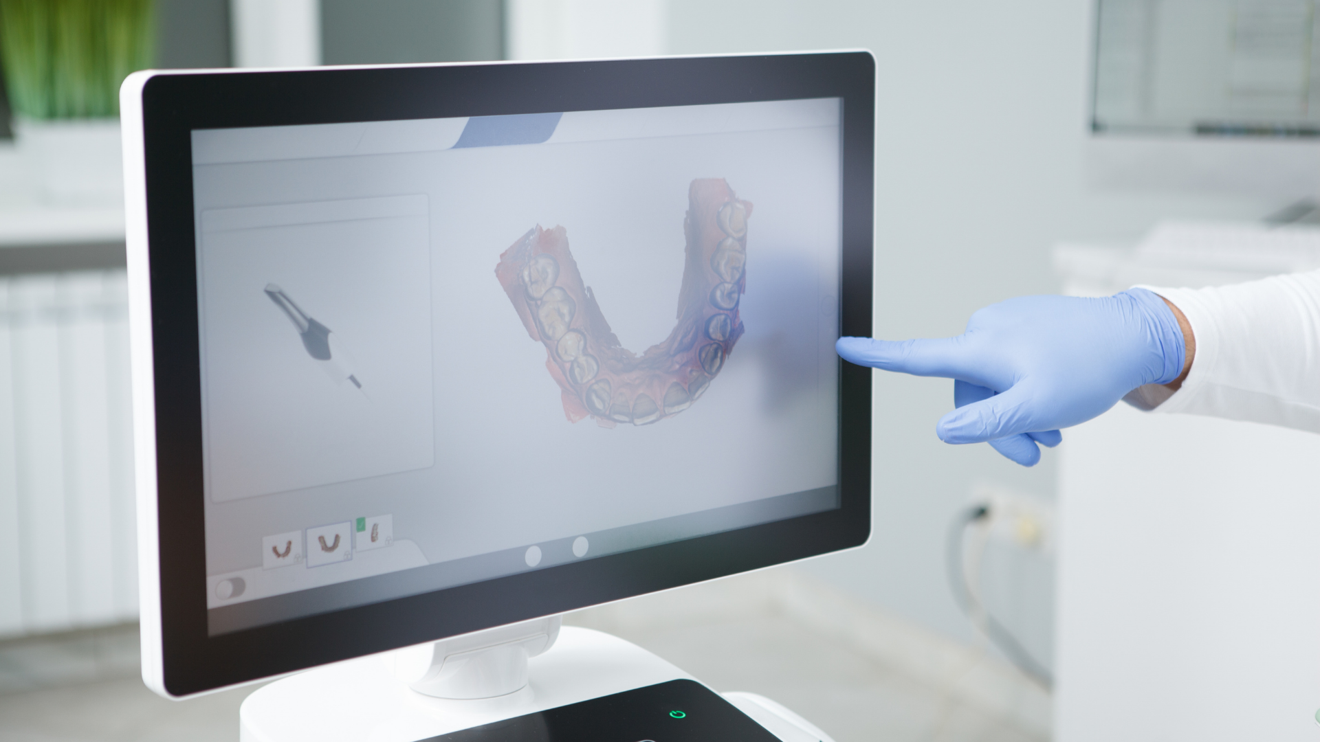 3D Diş Tarayıcı - Intraoral Scanner